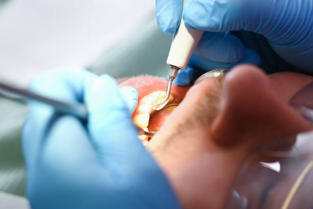Best Dentist Open Late Near Me  in North Potomac, MD